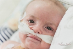 160322 Nate Clarke PICU at 5.5weeks-2127